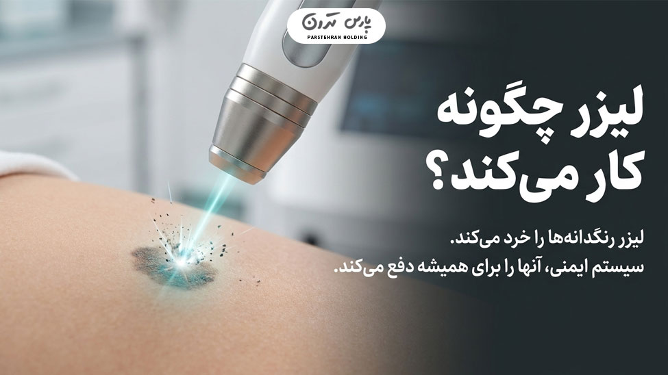 How is laser tattoo removal done in Mashhad پاک كردن تاتو با ليزر در مشهد چگونه انجام می شود؟