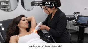 Underarm-laser-whitening