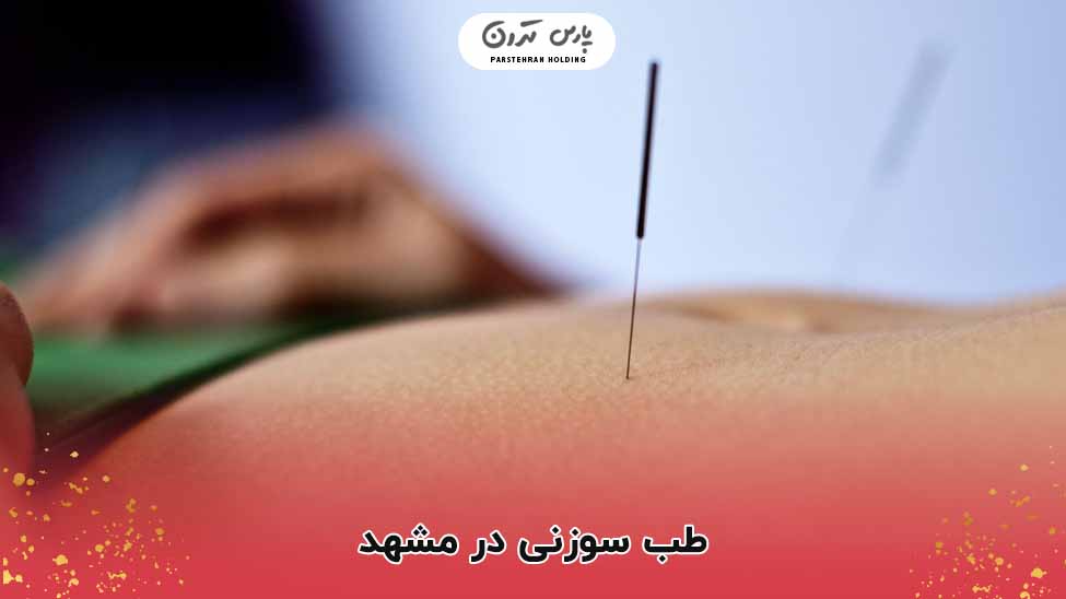 طب سوزنی در مشهد
