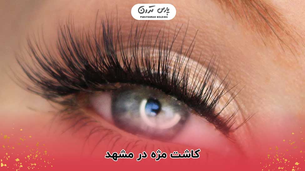 کاشت مژه در مشهد