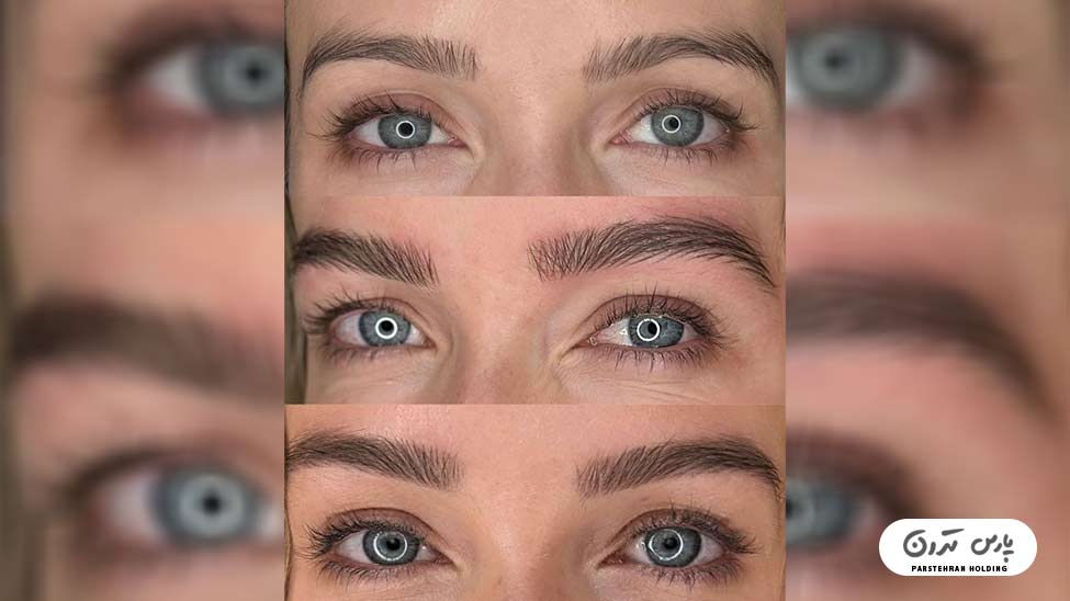 Types of eyebrow fibrosis models10 فیبروز ابرو پرپشت و مدرن