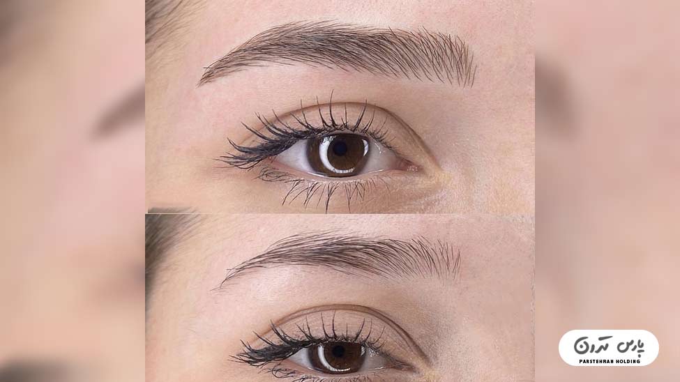 Types of eyebrow fibrosis models11 طراحی ابرو با روش فیبروز مدرن