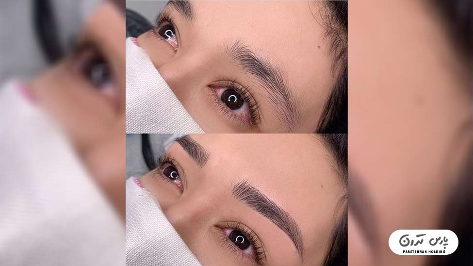 Types of eyebrow fibrosis models13 فیبروز ابرو مویی و طبیعی