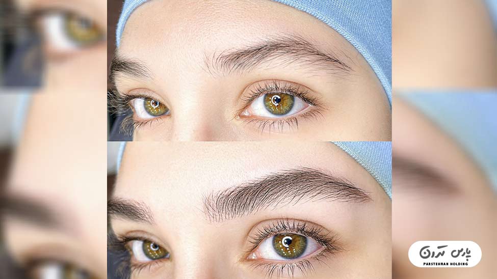 Types of eyebrow fibrosis models16 مدل فیبروز ابرو نچرال