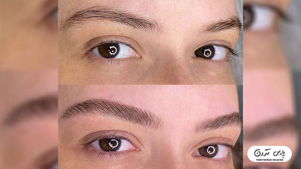 Types of eyebrow fibrosis models18 فیبروز ابرو مویی با طراحی ظریف