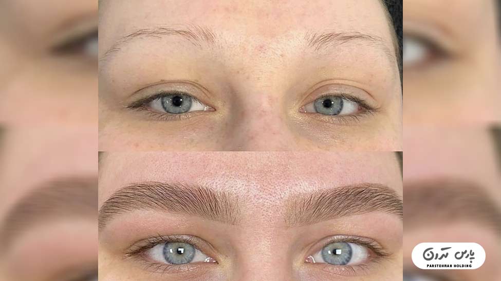 Types of eyebrow fibrosis models19 جدیدترین فیبروز ابرو پرپشت