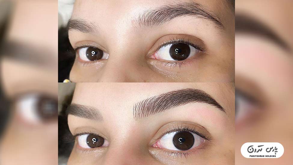 Types of eyebrow fibrosis models20 فیبروز ابرو نچرال با فرم پرپشت