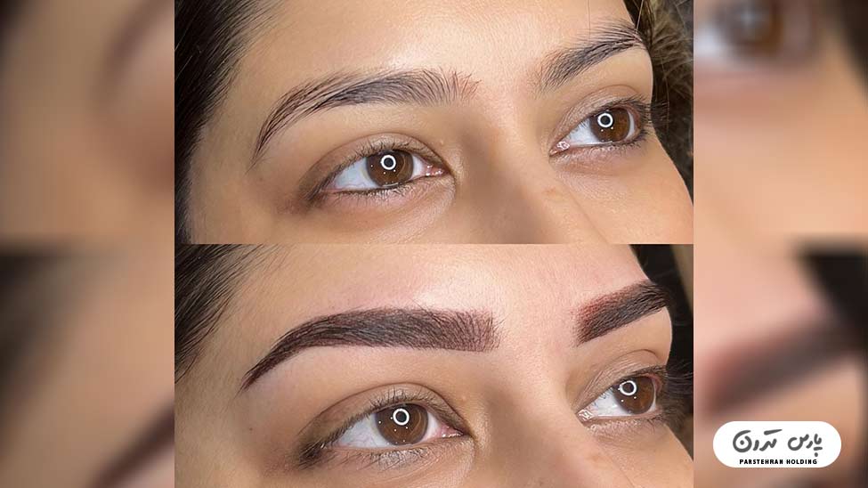 Types of eyebrow fibrosis models21 فیبروز ابرو لاکچری با طراحی حرفه ای