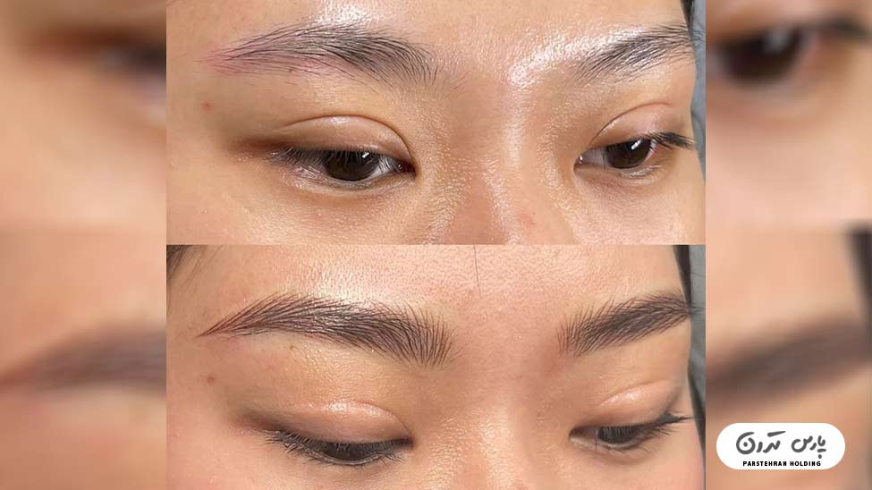 Types of eyebrow fibrosis models5 مدل فیبروز ابرو خاص و لاکچری