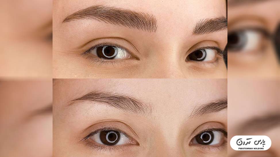 Types of eyebrow fibrosis models7 مدل فیبروز ابرو ساده و شیک