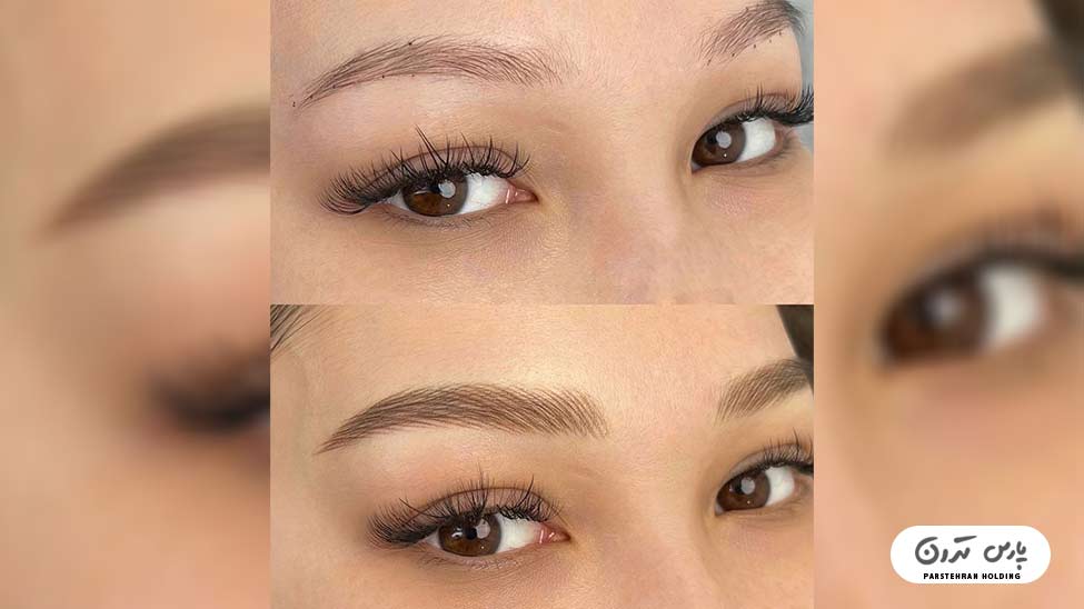 Types of eyebrow fibrosis models8 مدل فیبروز ابرو به سبک جدید
