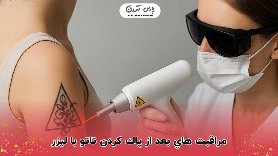 care after laser tattoo removal مراقبت هاي بعد از پاك كردن تاتو با ليزر