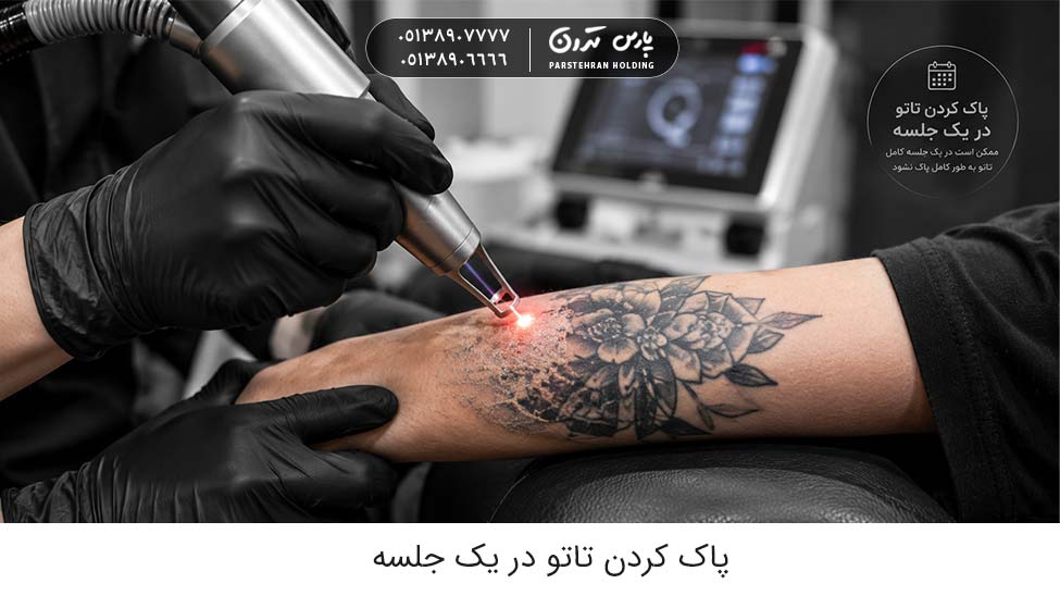 tattoo removal in one session 1 پاك كردن تاتو در يك جلسه
