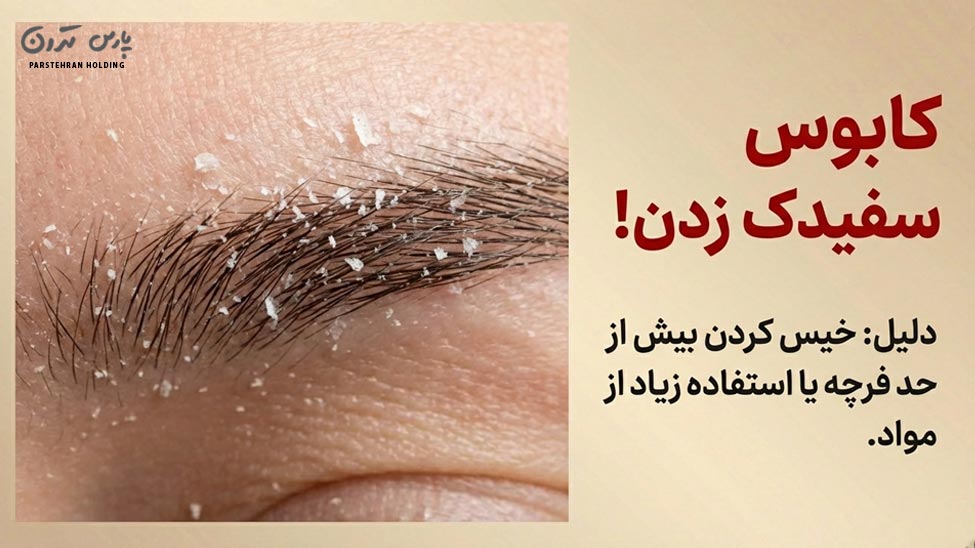Pars tehran mag جلوگیری از سفیدک زدن صابون ابرو