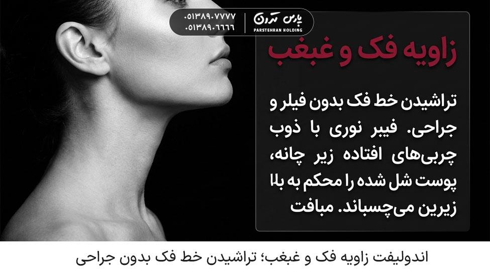 Jaw angle and double chin endolift اندولیفت زاویه فک و غبغب