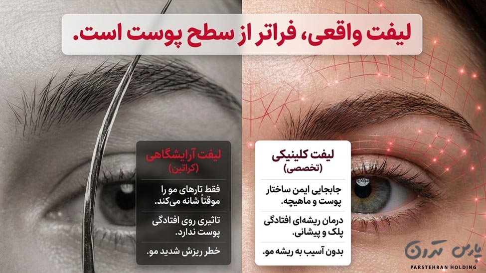 The difference between eyebrow lift and salon materials and specialized clinical techniques تفاوت لیفت ابرو با مواد (آرایشگاهی) و تکنیکهای تخصصی کلینیکی