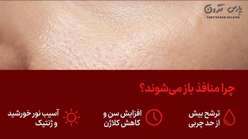 Why do skin pores become open and enlarged چرا منافذ پوست باز و گشاد میشوند؟