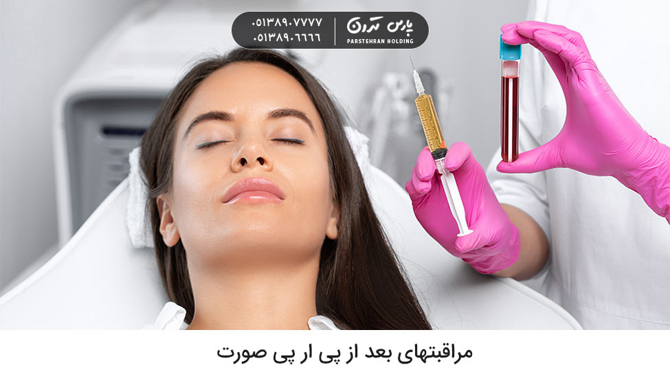 مراقبتهای بعد از پی ار پی صورت چیست
