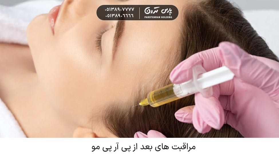 مراقبت های بعد از پی آر پی مو چیست