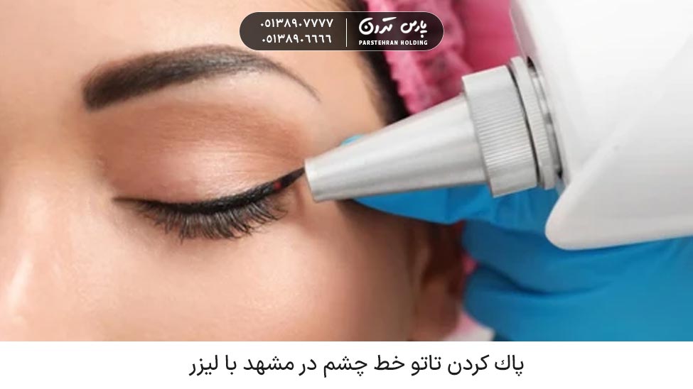 Removing eyeliner tattoo پاك كردن تاتو خط چشم در مشهد با لیزر با قیمت مناسب