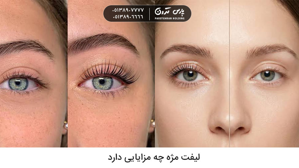 What are the benefits of eyelash lift لیفت مژه چه مزایایی دارد