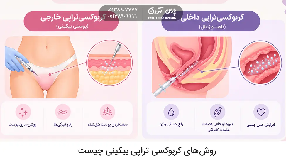 What are bikini carboxytherapy methods 1 روش های کربوکسی تراپی بیکینی چیست