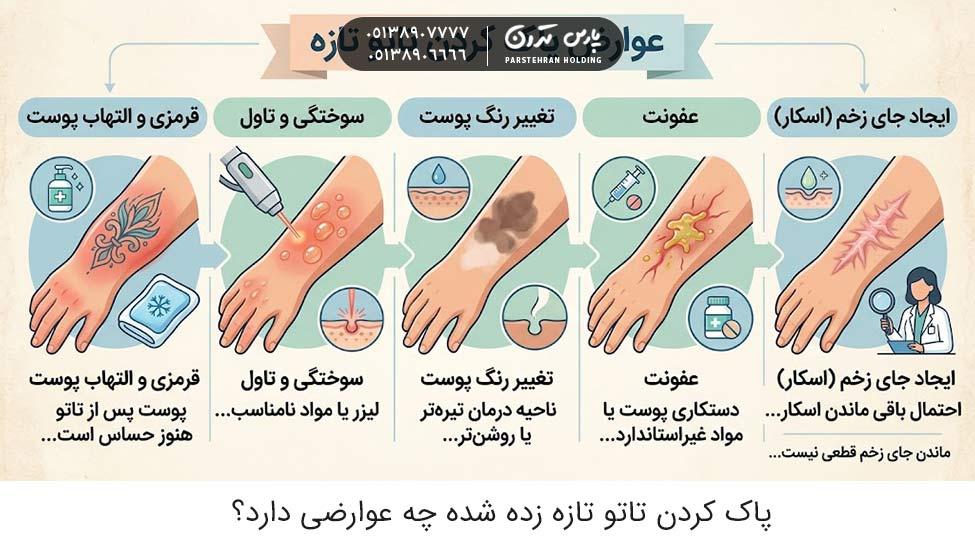 What are the side effects of removing a freshly applied tattoo پاک کردن تاتو تازه زده شده چه عوارضی دارد؟